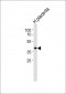 BCAT2 Antibody (N-term)